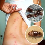 Bed Bug Treatment